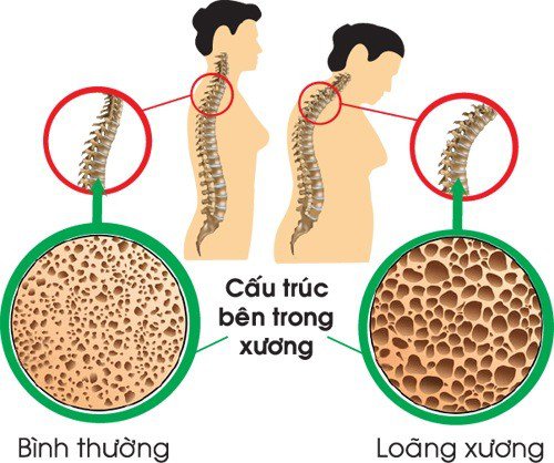 Calci Tảo ĐQ Hộp 60 viên - Bổ sung canxi và bổ dưỡng cho người bị loãng xương, trẻ suy dinh dưỡng còi xương.