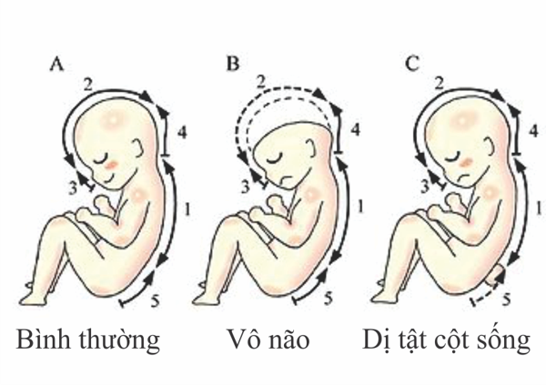 bổ sung axit folic