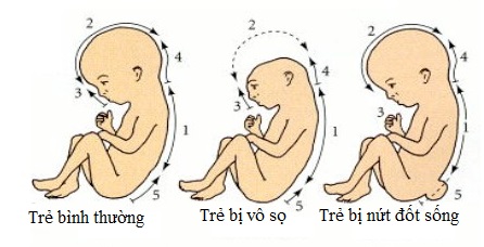 2, Tại sao cần bổ sung acid folic cho bà bầu? 1