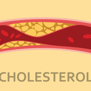 cholesterol máu