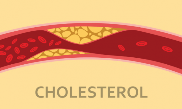 cholesterol máu