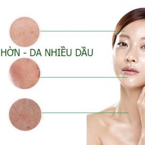 Ziaja Med Xanh - da nhờn