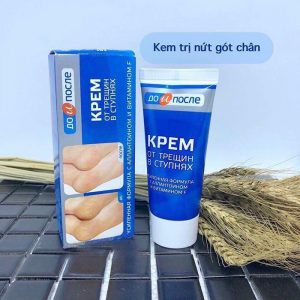 Kpem Tuýp 100ml - Kem trị nứt gót chân