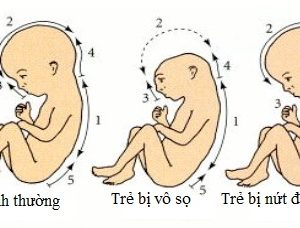 Tại sao cần bổ sung acid folic cho bà bầu?